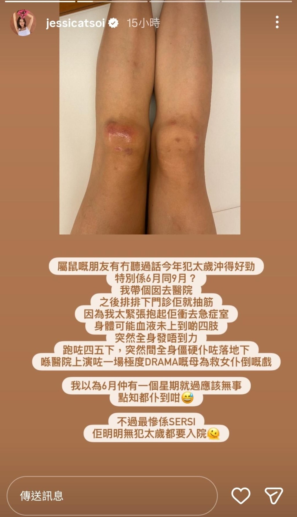 蔡明思因為救女受傷。 蔡明思因為救女受傷。