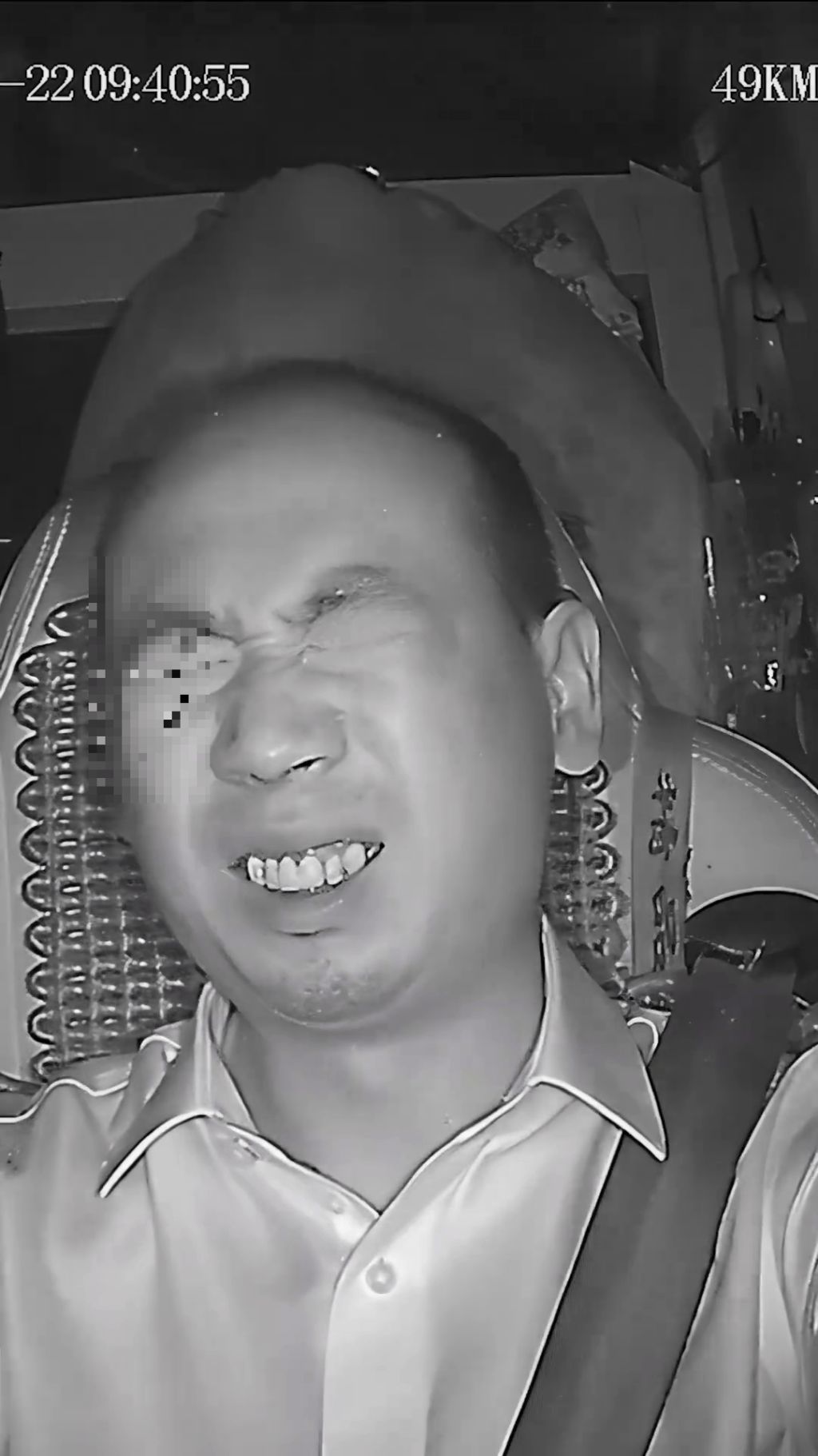 巴士司機李林雙眼被玻璃碎片刺傷雙眼。