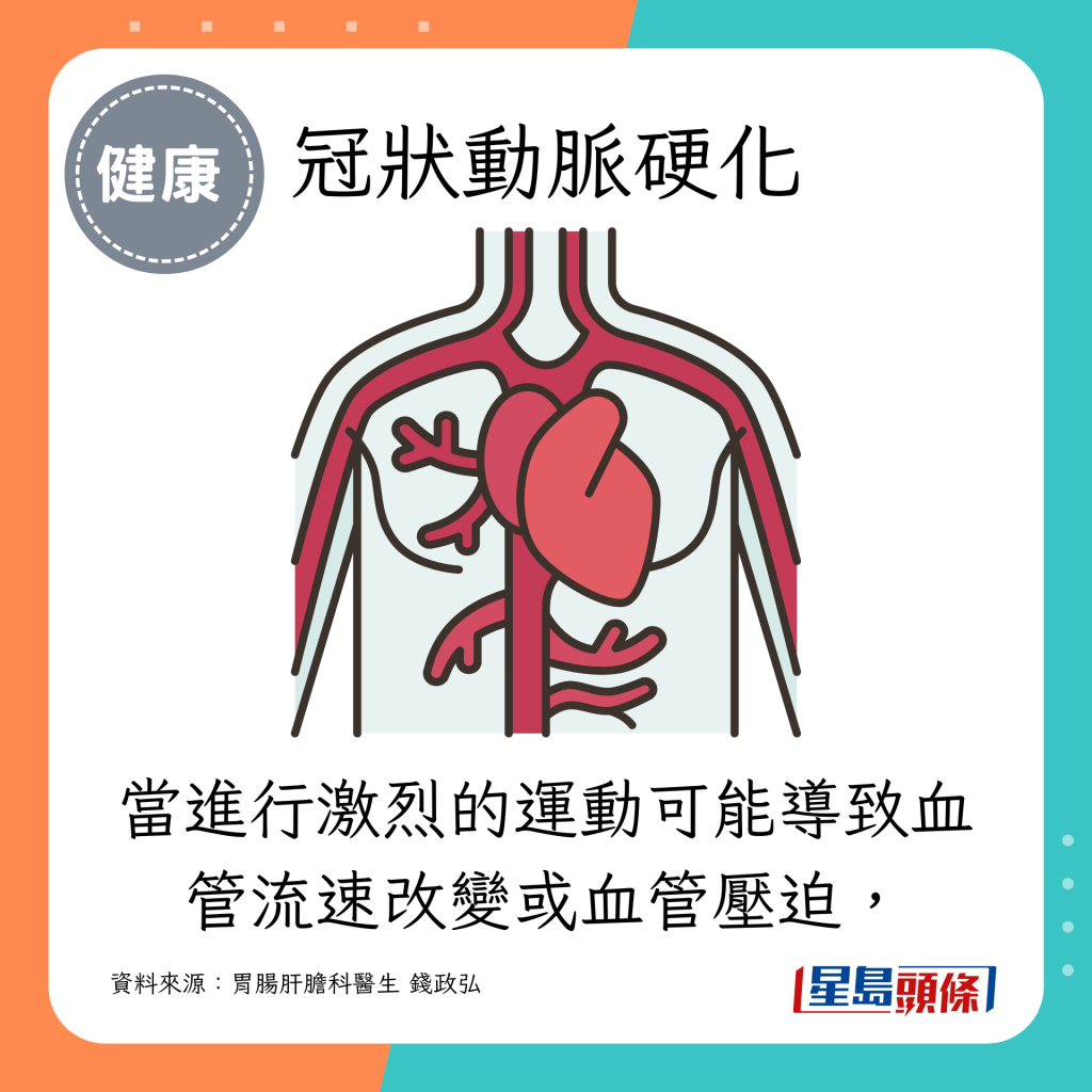 當進行激烈的運動可能導致血管流速改變或血管壓迫