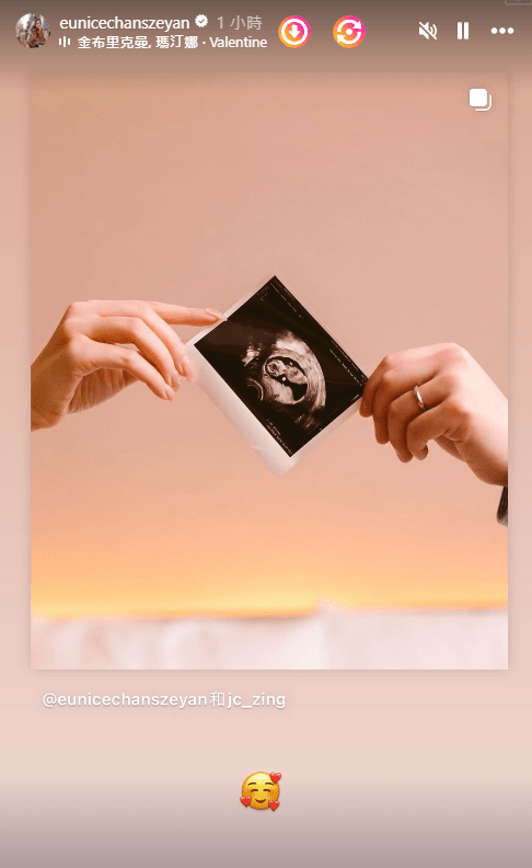 陳詩欣今日（14日）亦有在IG的限時動態貼出BB的超聲波照。