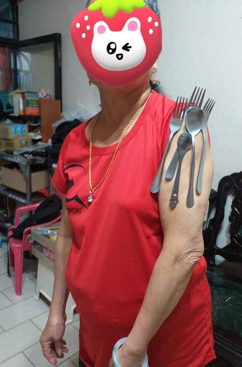 台灣新北市有一名婦人打了莫德納疫苗後，手臂竟可以吸叉子等餐具。網上圖片