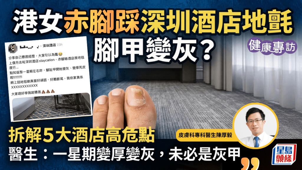 港女赤腳踩深圳酒店地氈、腳甲變灰？醫生：一星期急變未必是灰甲 附5大酒店高危點｜健康專訪