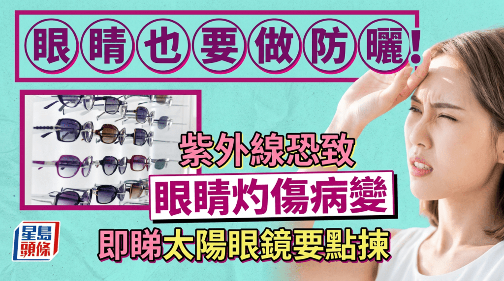 眼睛也要做防曬！專家解構紫外線恐致眼睛灼傷病變 太陽眼鏡要點揀？