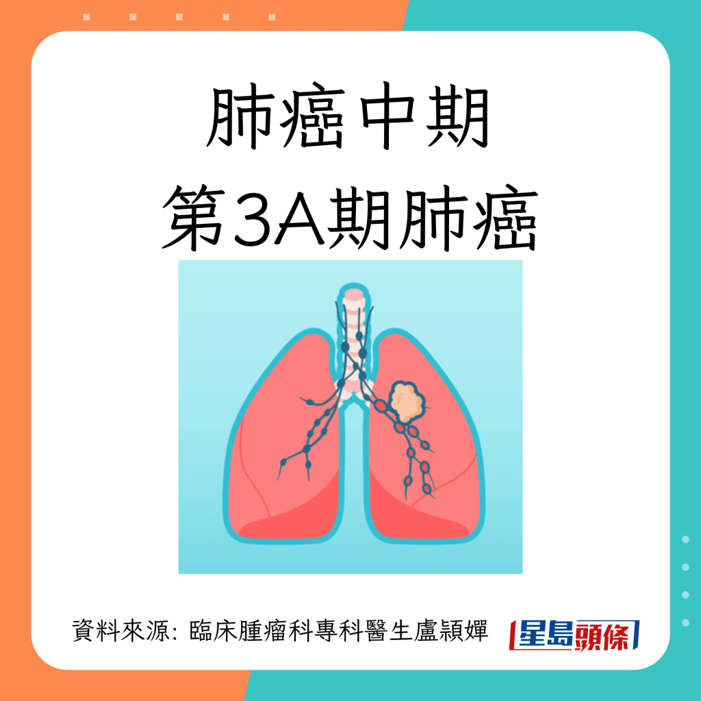 肺癌第1至4期治療方法