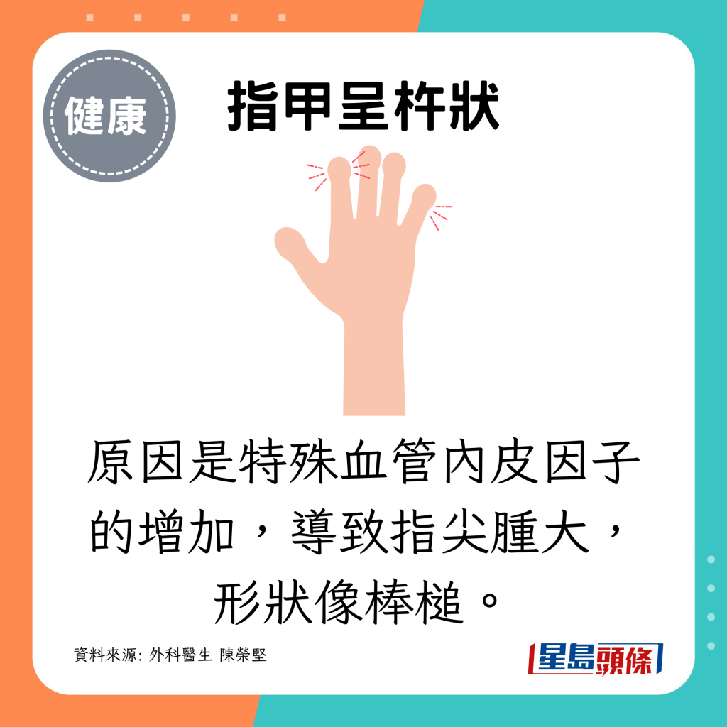 原因是特殊血管內皮因子的增加,導致指尖腫大,形狀像棒槌。