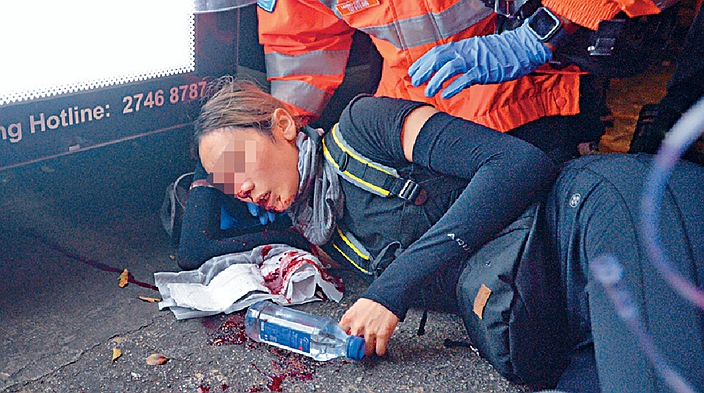 「爆眼女」當日受傷倒地。