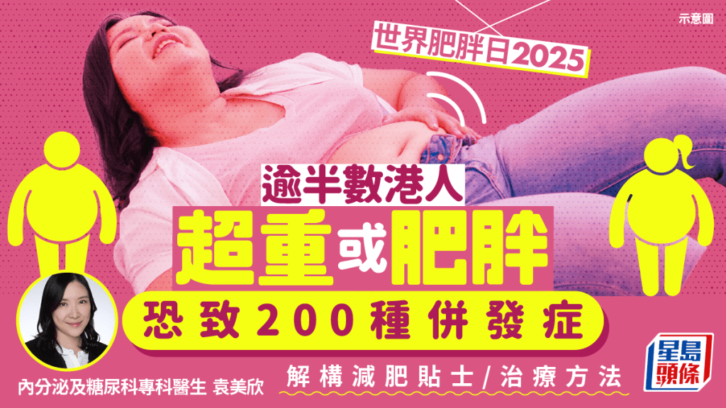 世界肥胖日2025｜逾半數港人超重或肥胖 恐致200種併發症 醫生解構減肥貼士/治療方法