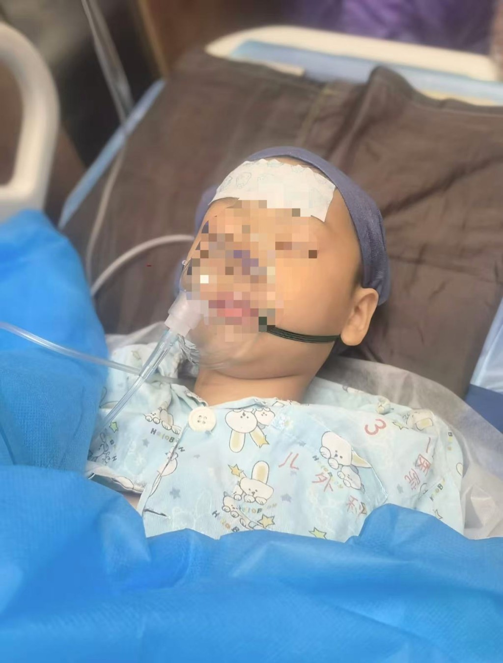 6歲男童沙灘赤腳踩到死魚被扎傷,高燒昏迷險截肢。抖音@路過的風景 6歲男童沙灘赤腳踩到死魚被扎傷,高燒昏迷險截肢。抖音@路過的風景