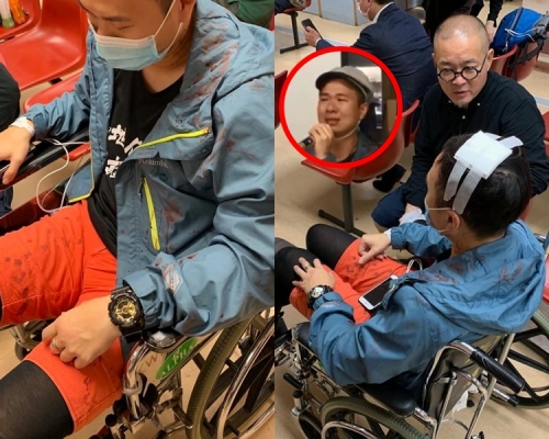 社工Key在記者會上表示，遭警方以警棍打了5棍。網圖