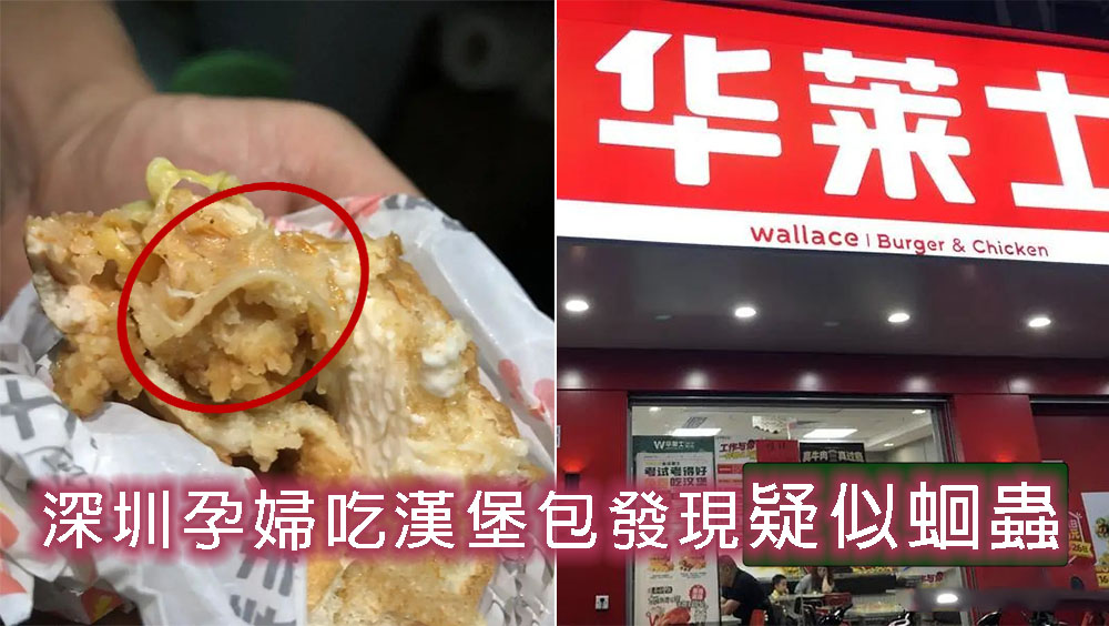 深圳孕婦吃漢堡包發現疑似蛔蟲。