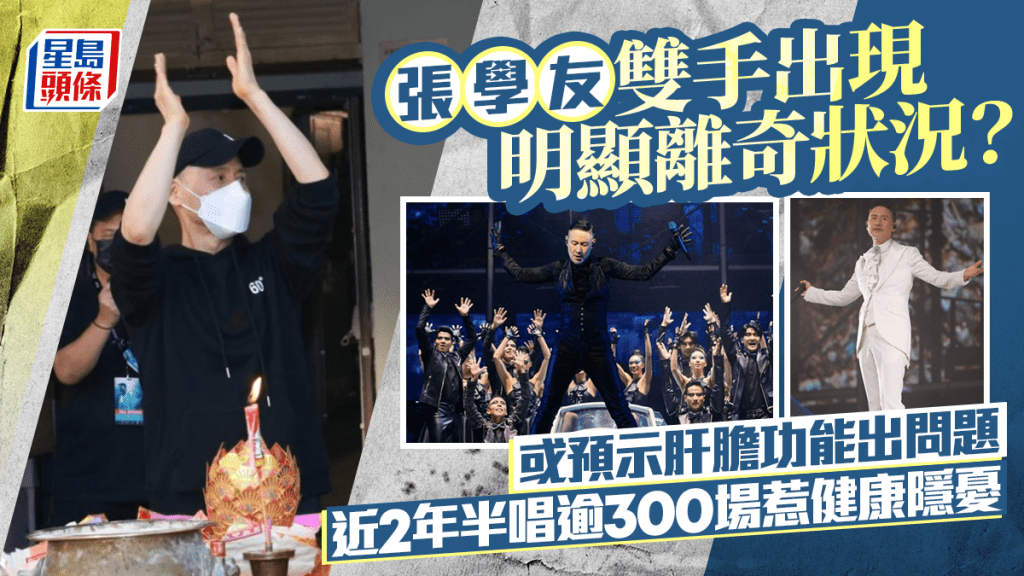 張學友雙手出現明顯離奇狀況？  或預示肝膽功能出問題  近2年半唱逾300場惹健康隱憂