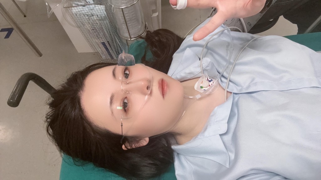 江蘇女子喂微毒的豬鼻蛇被咬，手腫如氣球。抖音