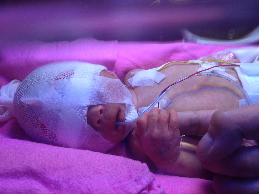 希希出生只有數天，便需要在新生嬰兒深切治療部接受觀察及治療。