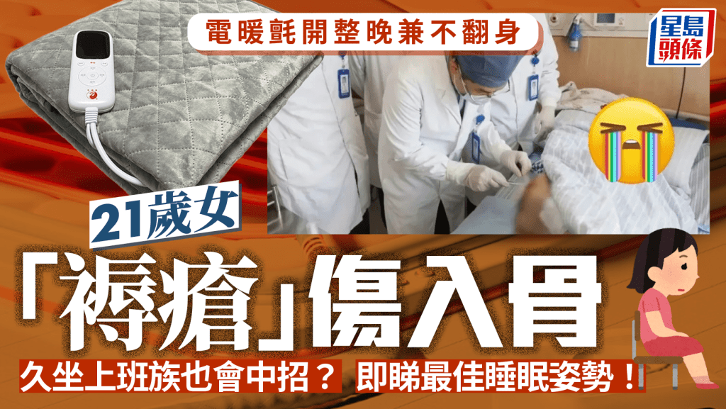 「電熱氈」開整夜又不翻身  浙江女「褥瘡」傷入骨無法起床