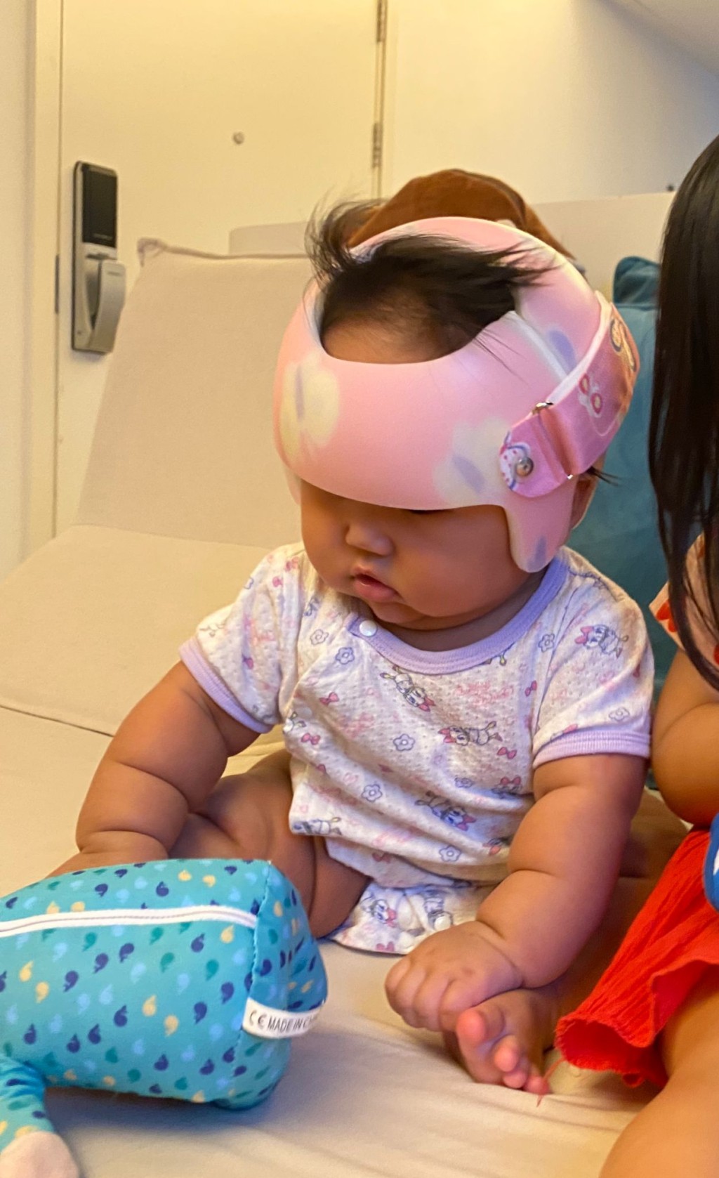 刘小姐的 BB 需长时间配戴矫形头盔以改善扁头症。（受访者提供）