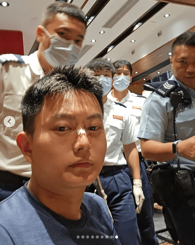 遇襲者葉子健在社交平台展示傷勢。葉子健IG