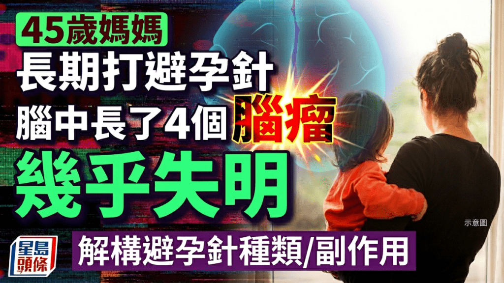 45岁妈妈长期打避孕针 脑中长了4个脑瘤几乎失明 解构避孕针种类/副作用