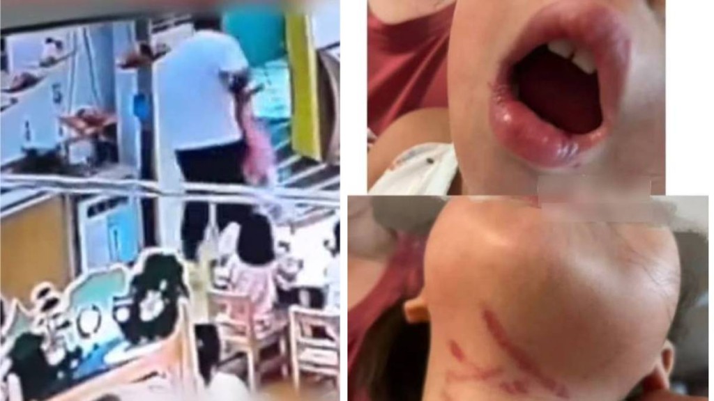 中山男幼稚園教師涉對3歲半女童暴力餵食，已被公安拘留。南方都市報