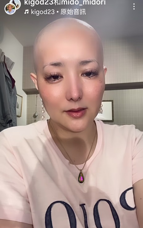 希良梨去年9月確診癌症復發,今年4月更透露因抗癌副作用的各種痛苦不適。 希良梨去年9月確診癌症復發,今年4月更透露因抗癌副作用的各種痛苦不適。