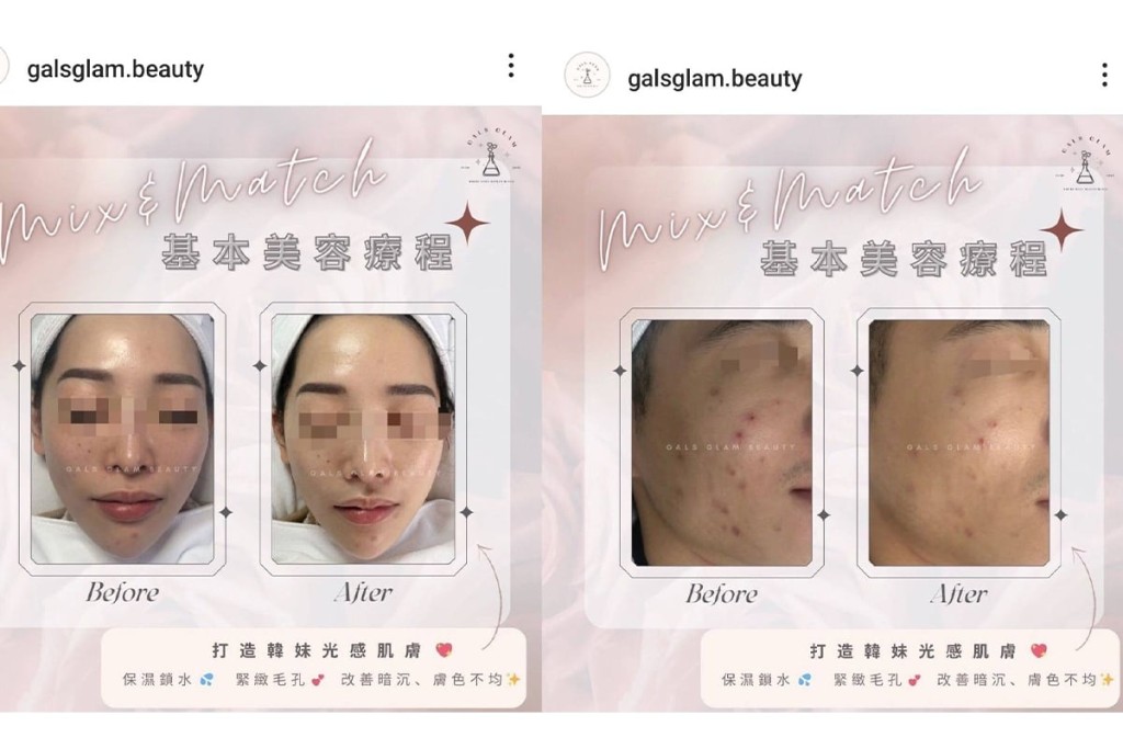 galsglam.beauty曾在Instagram宣传其美容疗程。