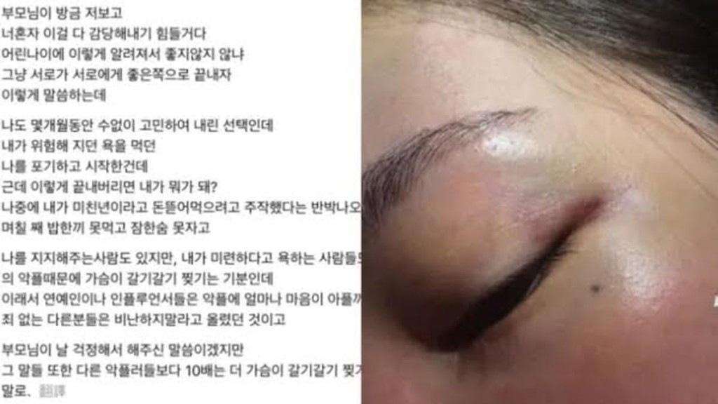 疑是Jisoo大嫂的A女在大爆家暴醜聞後翌日，亦為姑仔說話，澄清她毫不知情。