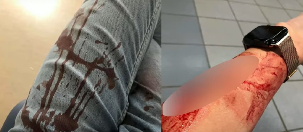 被斬傷男學生多處流血。網上圖片