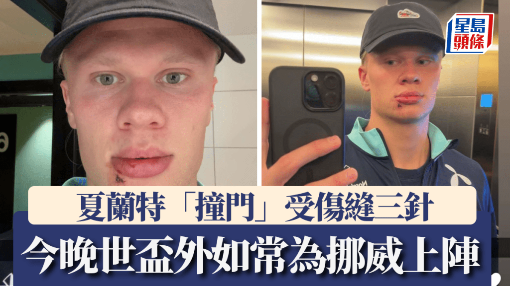 夏蘭特「撞門」受傷縫三針,無礙出戰世盃外圍賽。艾寧夏蘭特snapchat截圖