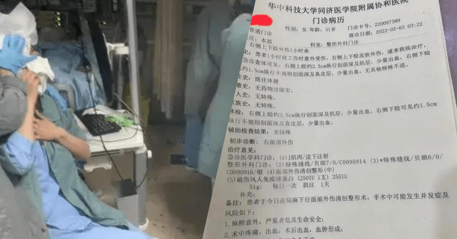 武汉一名女护士惨遭病人踢伤毁容。网图