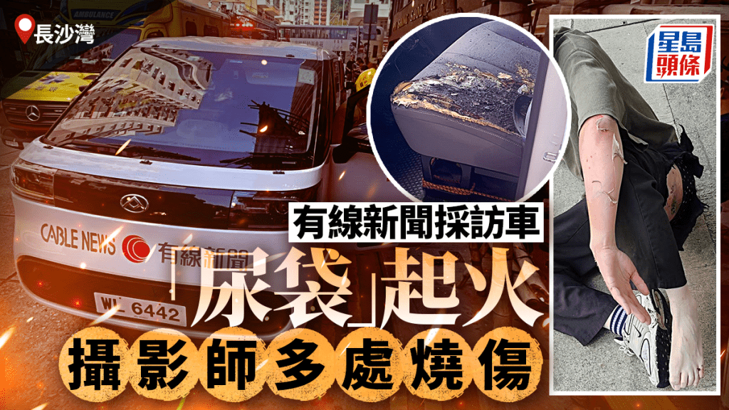 长沙湾有线新闻采访车「尿袋」起火　摄影师多处烧伤