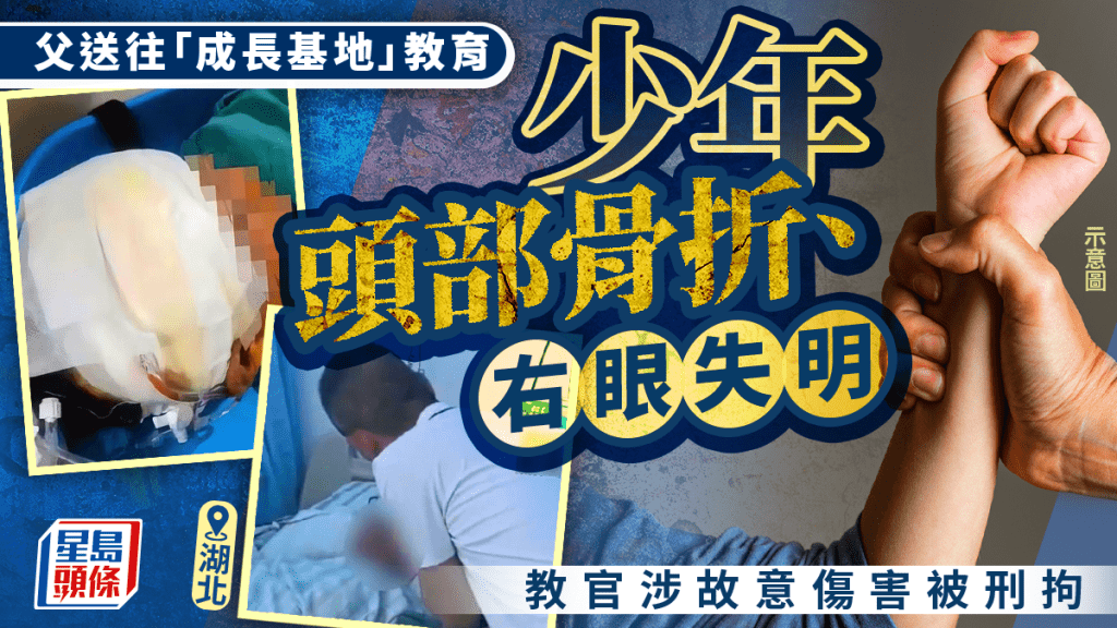 恐怖教學︱少年寫求救信被打至開腦失視力  湖北成長基地教官被刑拘