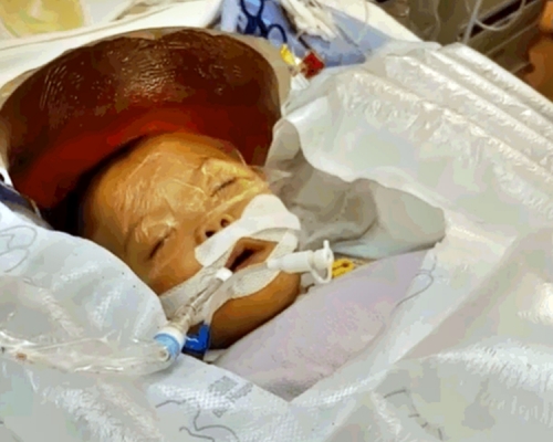 悅悅的母親表示，女兒體內的阿摩尼亞指數下降，醫生指不排除其肝臟有修復中的可能。「Coka.Kona Baby」FB影片截圖