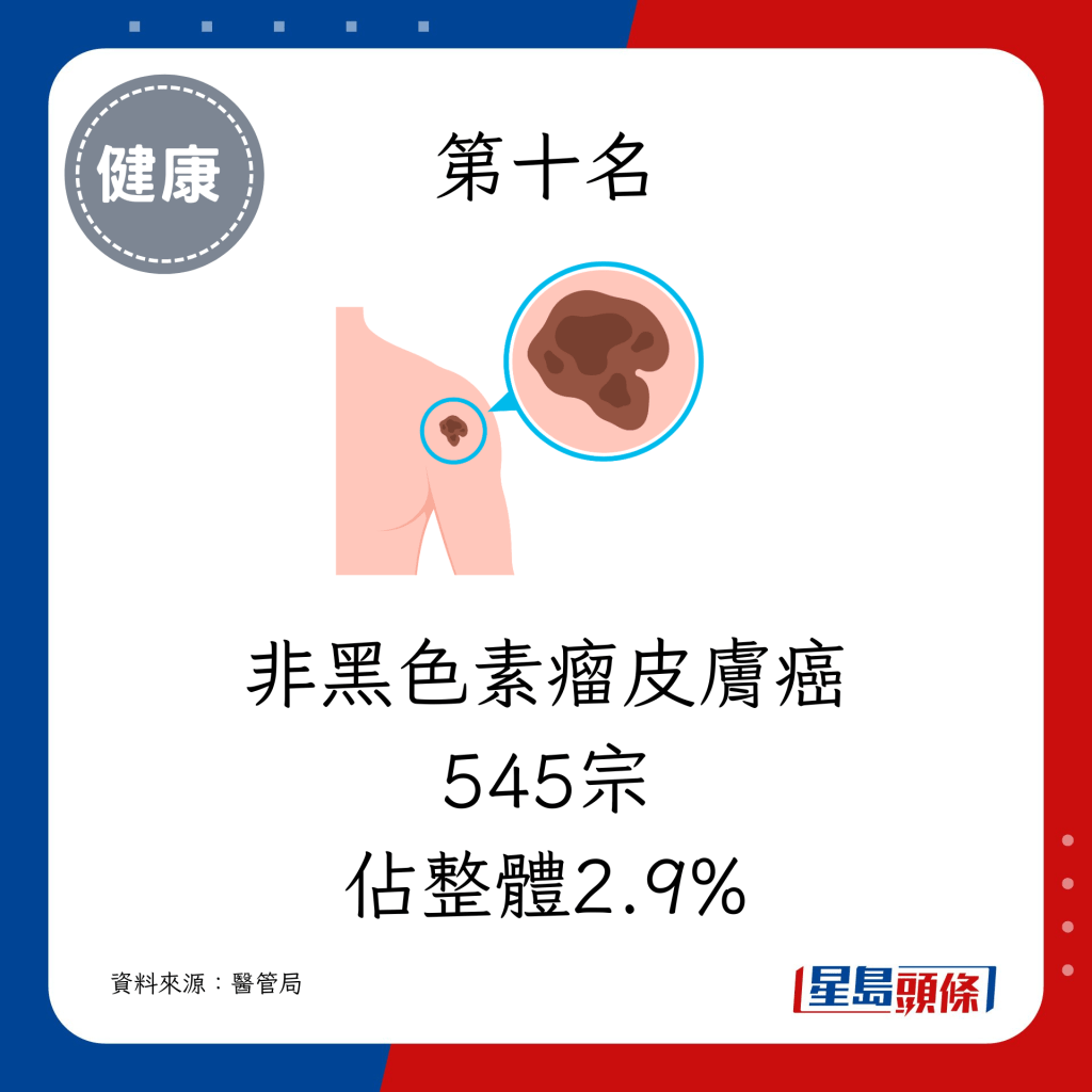  非黑色素瘤皮膚癌（545宗，佔整體2.9%）