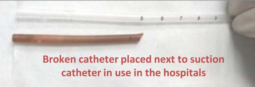 有病人體內遺留一段5厘米長導管。醫管局圖片