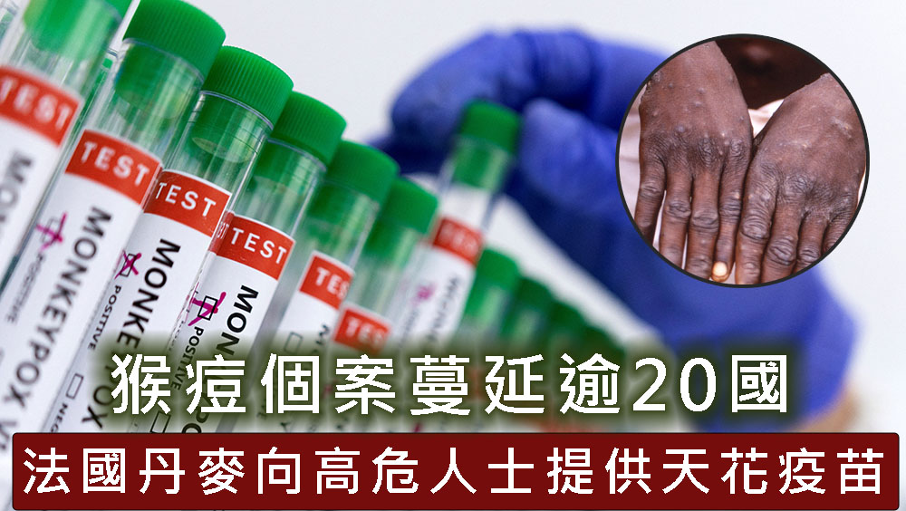 猴痘個案蔓延逾20國,法國丹麥向高危人士提供疫苗。AP