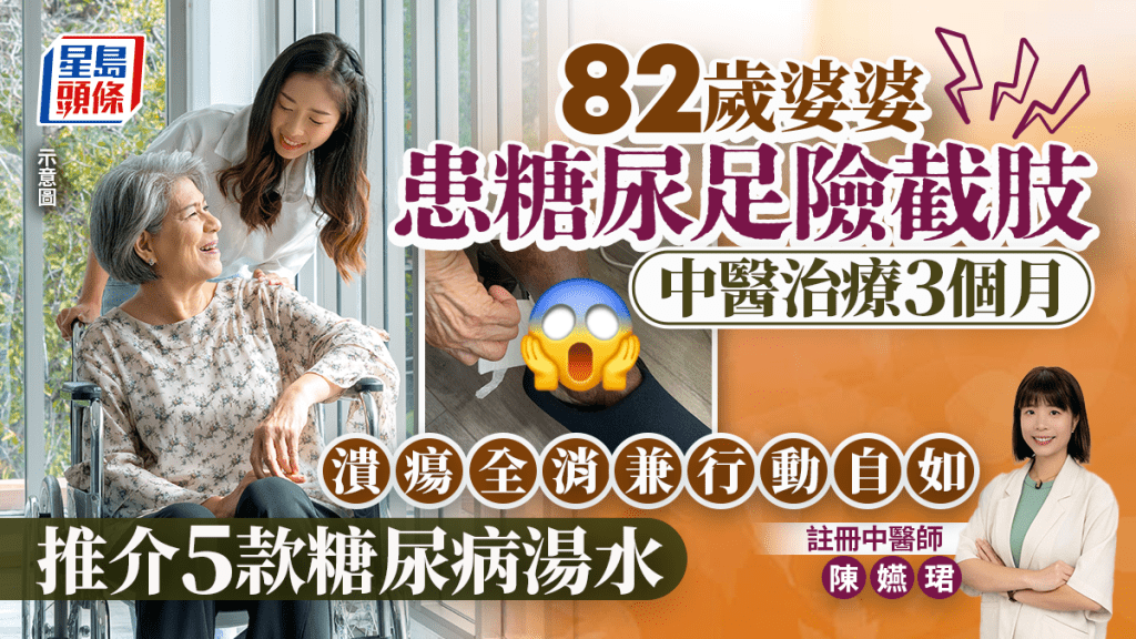 82歲婆婆患糖尿足險截肢 中醫治療3個月 潰瘍全消兼行動自如 推介5款糖尿病湯水