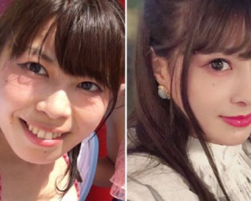 調查顯示日本去年進行的整形手術9成集中於面部。網圖