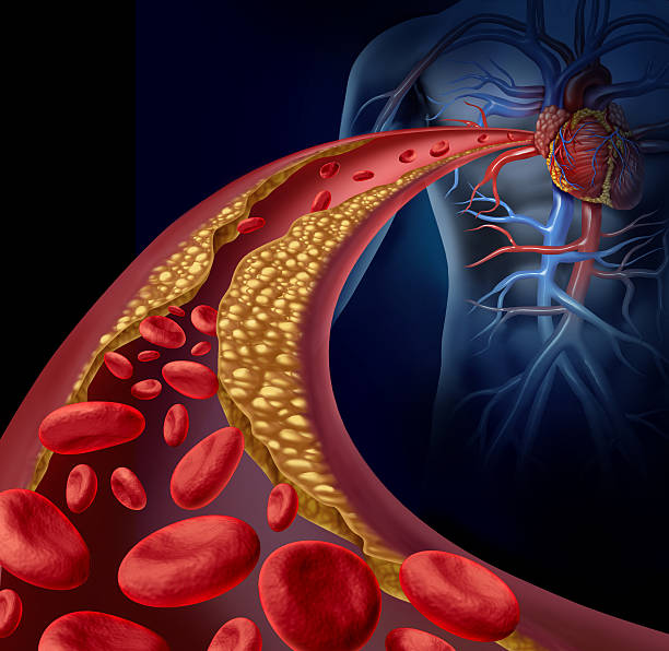 龙利医生指出，彭男血液非常黏稠，影响全身循环，大脑、心脏等重要器官的供血严重不足（图片来源：iStock）