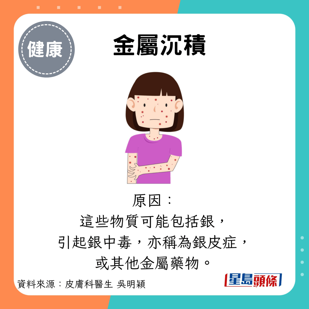 金屬沉積：原因： 這些物質可能包括銀， 引起銀中毒，亦稱為銀皮症， 或其他金屬藥物。