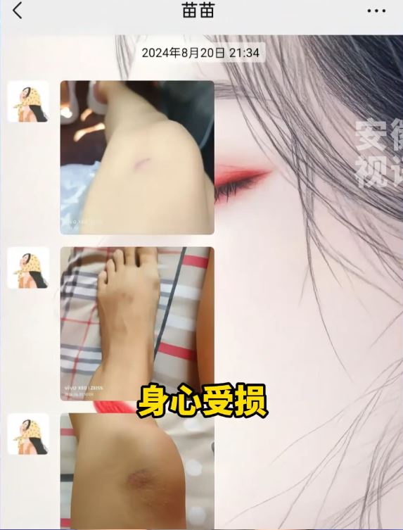 死者苗苗婚後長年遭被告家暴。