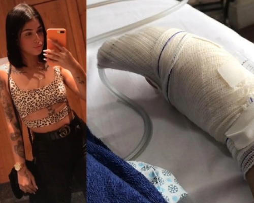 巴西女子因为美甲而最终要切去部分手指。 （网上图片）