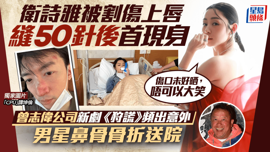 衛詩雅受傷縫50針後首現身：唔可以大笑  日前被割傷上唇  曾志偉公司新劇《狩謊》連出意外