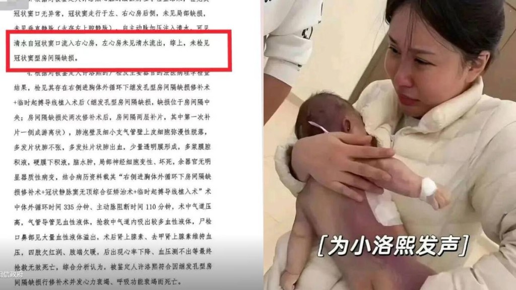 小洛熙母親聲稱主診醫生指女嬰當時情況危急，必須開刀。抖音＠小洛熙媽媽