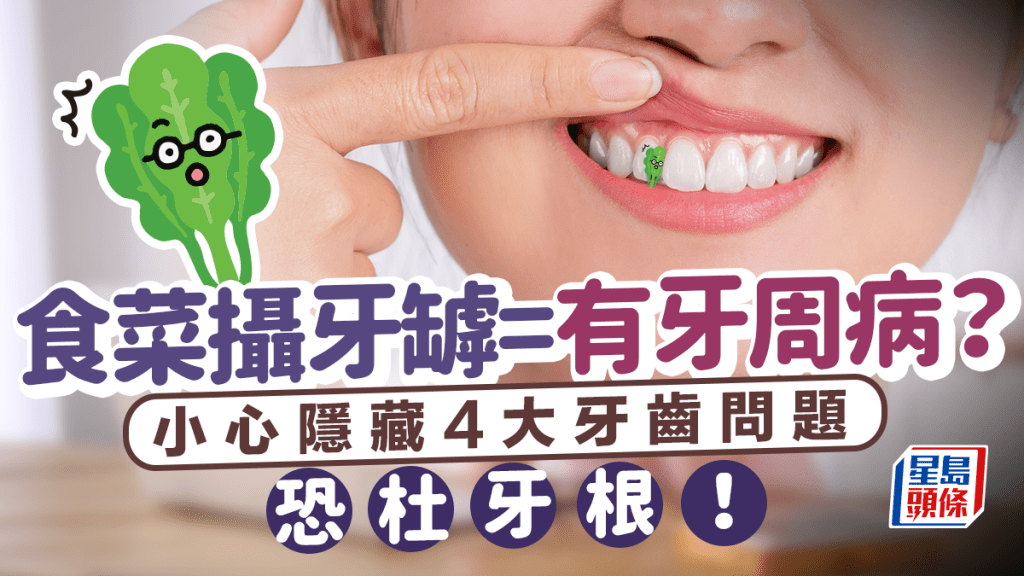 牙齒健康｜牙縫卡菜渣=患牙周病？攝牙罅恐藏4大問題須杜牙根