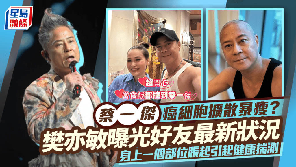 蔡一傑癌細胞擴散暴瘦？  樊亦敏曝光好友最新狀況  身上一個部位脹起引起健康揣測