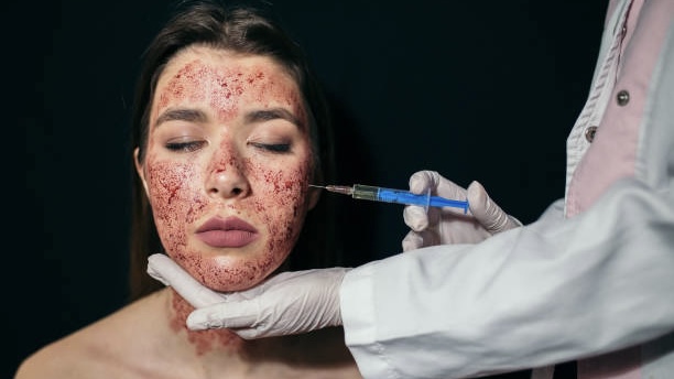美國3名女子證實透過一間美容院的「吸血鬼美容」療程感染愛滋。 iStock配圖