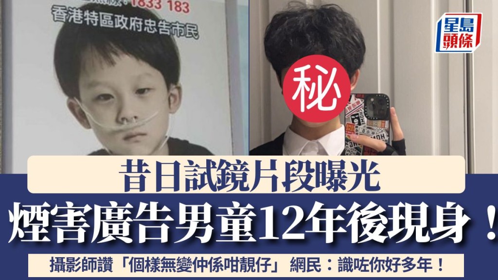 煙害廣告男童12年後現身!昔日試鏡片段曝光 攝影師讚「個樣無變仲係咁靚仔」 網民:識咗你好多年!