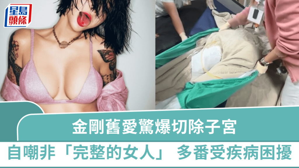 金剛舊愛驚爆切除子宮 崩潰自嘲「不是完整的女人」 身體連番受疾病困擾陷低谷