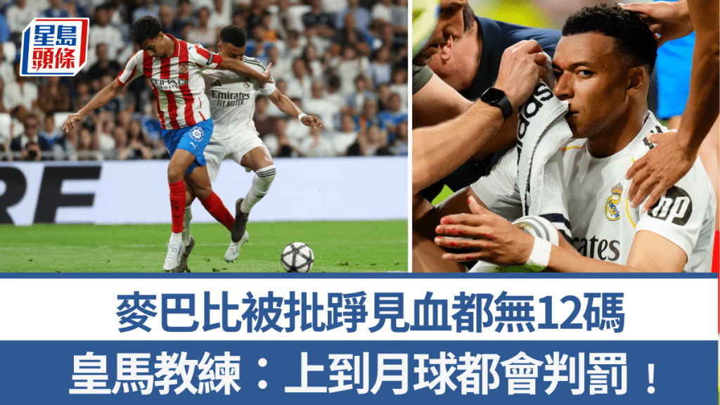 麥巴比被批踭見血都無12碼，皇馬不滿怒斥。法新社