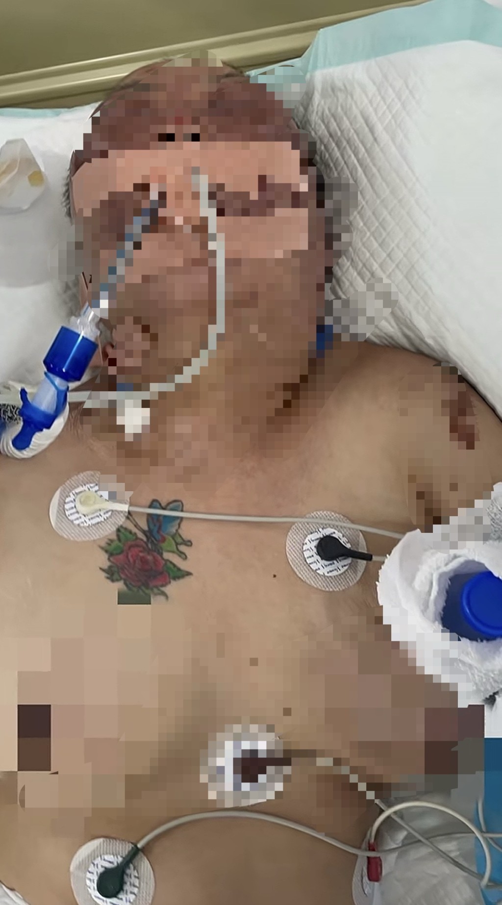 遼寧43歲女子遭前夫毒打直腸破裂亡。抖音@張麗萍女兒-嚴懲兇手