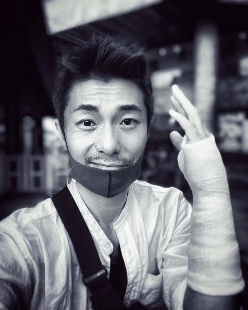 周國賢因拍拳擊場面受傷,要休息一段日子。